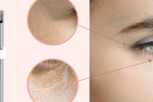 product_pdo_facial02